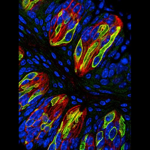  NCBI Organism:Mus musculus; Cell Types:taste receptor cell, type II taste cell;