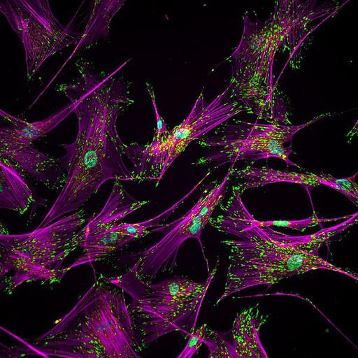  NCBI Organism:Homo sapiens; Cell Types:fibroblast of lung Cell Components:cytoskeleton Biological process:cell adhesion