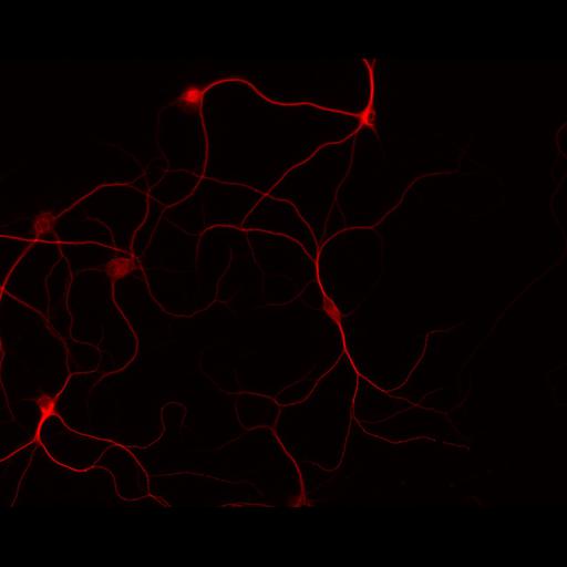  NCBI Organism:Rattus; Cell Types:multipolar neuron Cell Components:cytoskeleton, microtubule cytoskeleton, dendrite; Biological process:neuron development, dendrite development;