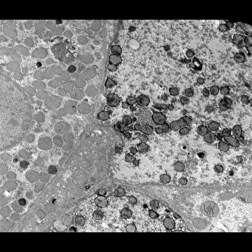  NCBI Organism:Homo sapiens; Cell Components:mitochondrion, peroxisome;