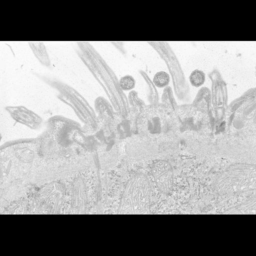  NCBI Organism:Didinium nasutum; Cell Types:eukaryotic cell, , ; Cell Components:cell cortex, cilium, microtubule basal body, ciliary rootlet, mitochondrion; Biological process:ciliary cell motility, microtubule cytoskeleton organization;