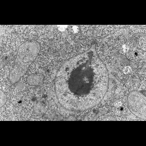  NCBI Organism:Didinium nasutum; Cell Types:cell by organism, eukaryotic cell, , ; Cell Components:micronucleus, nuclear heterochromatin, condensed nuclear chromosome, nuclear envelope, spindle microtubule; Biological process:mitotic anaphase