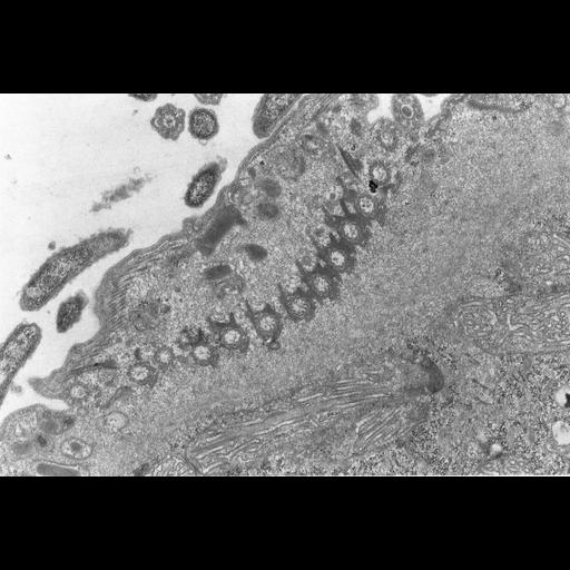  NCBI Organism:Didinium nasutum; Cell Types:eukaryotic cell, , ; Cell Components:cell cortex, cilium, microtubule basal body, ciliary rootlet, ; Biological process:ciliary cell motility, microtubule cytoskeleton organization, , detection of symbiotic bacterium;