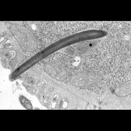  NCBI Organism:Didinium nasutum; Cell Types:eukaryotic cell, , ; Cell Components:cell cortex, , , ; Biological process:, , ;