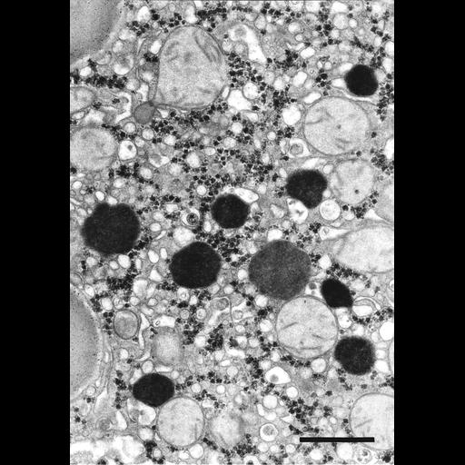  NCBI Organism:Homo sapiens; Cell Types:parenchymal cell Cell Components:peroxisome, mitochondrion, smooth endoplasmic reticulum;