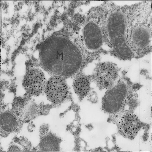  NCBI Organism:Homo sapiens; Cell Types:parenchymal cell Cell Components:peroxisome, mitochondrion; Biological process:regulation of transferase activity