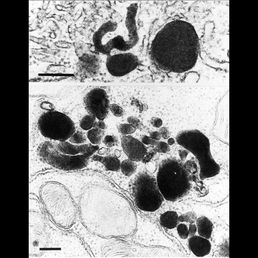  NCBI Organism:Mus musculus; Cell Types:epithelial cell Cell Components:peroxisome Biological process:peroxisome fission