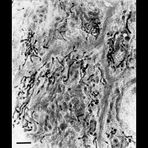  NCBI Organism:Homo sapiens; Cell Types:epithelial cell Cell Components:peroxisome