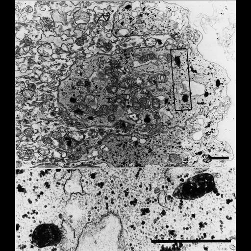  NCBI Organism:Homo sapiens; Cell Types:mononuclear cytotrophoblast cell Cell Components:peroxisome