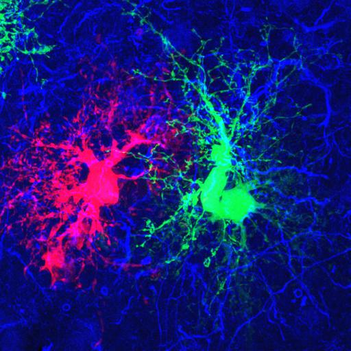  NCBI Organism:Rattus norvegicus; Cell Types:astrocyte, astrocyte of the hippocampus; Cell Components:cell projection cytoplasm, cell body; Biological process:forebrain astrocyte development, cell projection organization;