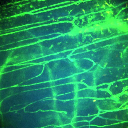  NCBI Organism:Staphylococcus aureus; Cell Types:neutrophil, endothelial cell;