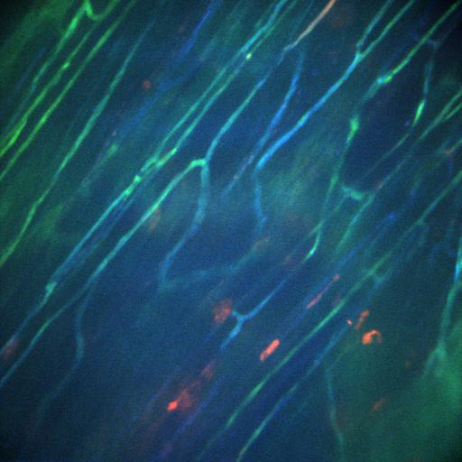  NCBI Organism:Staphylococcus aureus; Cell Types:neutrophil, endothelial cell;