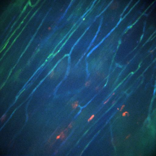  NCBI Organism:Staphylococcus aureus; Cell Types:neutrophil, endothelial cell;