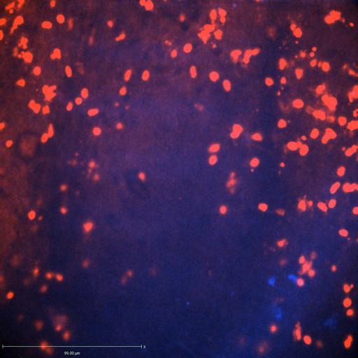  NCBI Organism:Staphylococcus aureus; Cell Types:neutrophil, endothelial cell; Biological process:cell death