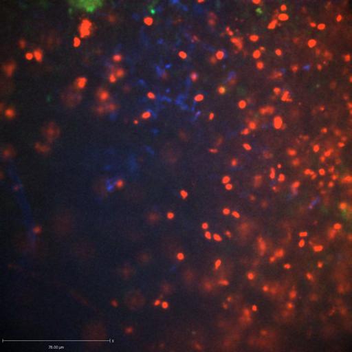  NCBI Organism:Staphylococcus aureus; Cell Types:neutrophil, endothelial cell; Biological process:cell death