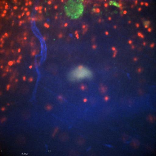  NCBI Organism:Staphylococcus aureus; Cell Types:neutrophil, endothelial cell; Biological process:cell death