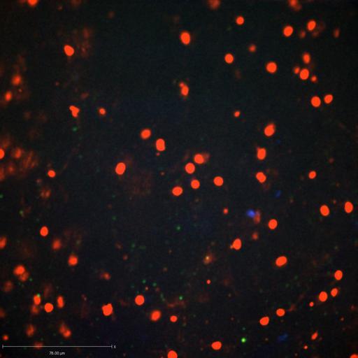  NCBI Organism:Staphylococcus aureus; Cell Types:neutrophil, endothelial cell; Biological process:cell death