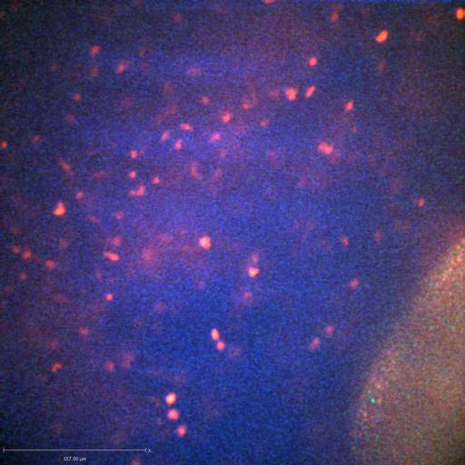  NCBI Organism:Staphylococcus aureus; Cell Types:neutrophil, endothelial cell; Biological process:cell death