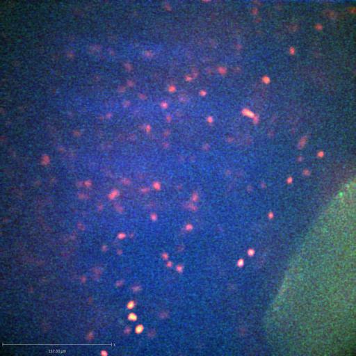  NCBI Organism:Staphylococcus aureus; Cell Types:neutrophil, endothelial cell; Biological process:cell death