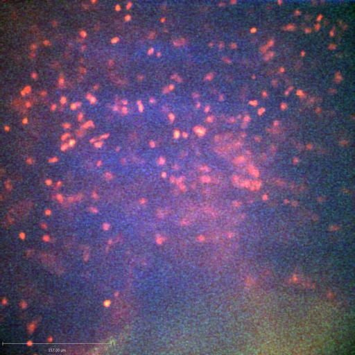  NCBI Organism:Staphylococcus aureus; Cell Types:neutrophil, endothelial cell; Biological process:cell death