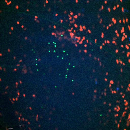  NCBI Organism:Staphylococcus aureus; Cell Types:neutrophil, endothelial cell; Biological process:cell death