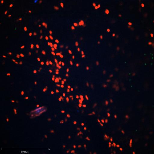  NCBI Organism:Staphylococcus aureus; Cell Types:neutrophil, endothelial cell; Biological process:cell death