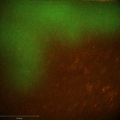  NCBI Organism:Staphylococcus aureus; Cell Types:neutrophil, endothelial cell; Biological process:cell death