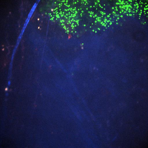 CIL:47504, Staphylococcus aureus, neutrophil, endothelial cell. CIL ...