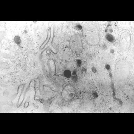  NCBI Organism:Homo sapiens; Cell Types:duct epithelial cell Cell Components:peroxisome