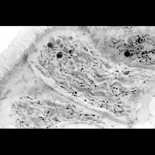  NCBI Organism:Homo sapiens; Cell Types:duct epithelial cell Cell Components:peroxisome