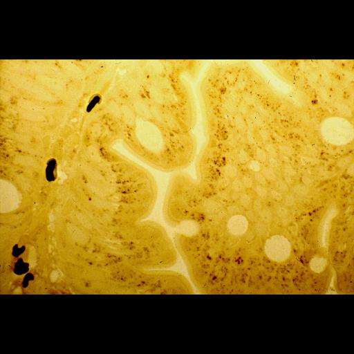  NCBI Organism:Homo sapiens; Cell Types:duct epithelial cell, goblet cell, erythrocyte; Cell Components:peroxisome