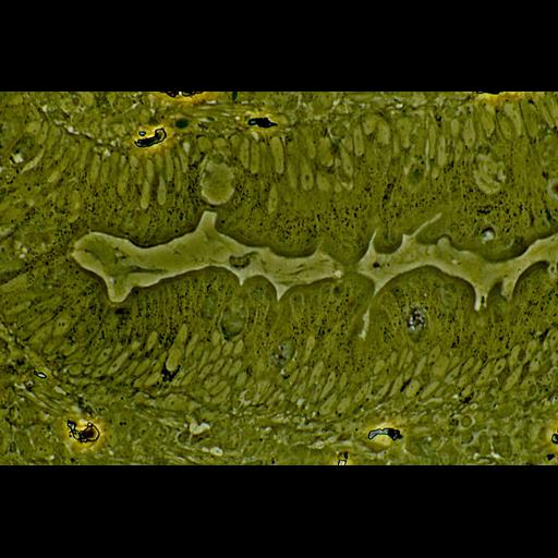  NCBI Organism:Homo sapiens; Cell Types:duct epithelial cell, goblet cell of epithelium of small intestine, erythrocyte; Cell Components:peroxisome