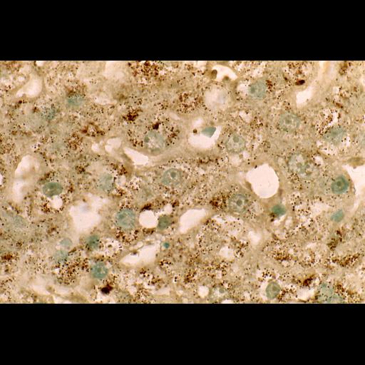  NCBI Organism:Homo sapiens; Cell Types:parenchymal cell Cell Components:peroxisome