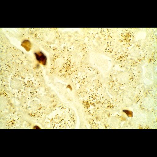  NCBI Organism:Homo sapiens; Cell Types:parenchymal cell Cell Components:peroxisome