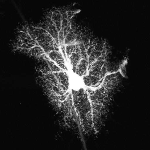  NCBI Organism:Rattus norvegicus; Cell Types:astrocyte, astrocyte of the hippocampus; Cell Components:cell projection cytoplasm, cell body; Biological process:forebrain astrocyte development, cell projection organization;