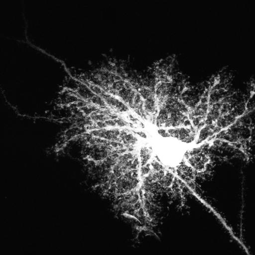  NCBI Organism:Rattus norvegicus; Cell Types:astrocyte, astrocyte of the hippocampus; Cell Components:cell projection cytoplasm, cell body; Biological process:forebrain astrocyte development, cell projection organization;