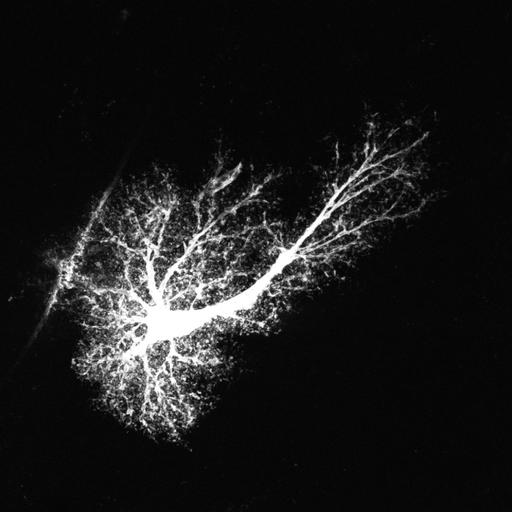  NCBI Organism:Rattus norvegicus; Cell Types:astrocyte, astrocyte of the hippocampus; Cell Components:cell projection cytoplasm, cell body; Biological process:forebrain astrocyte development, cell projection organization;