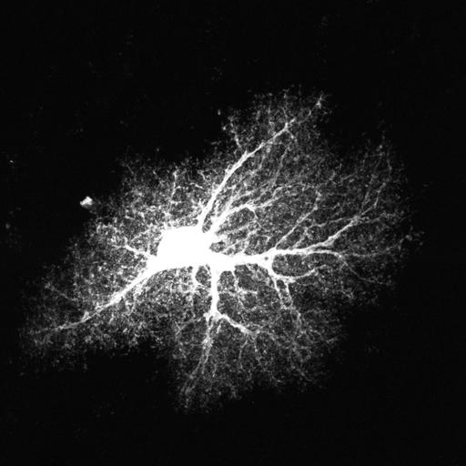  NCBI Organism:Rattus norvegicus; Cell Types:astrocyte, astrocyte of the hippocampus; Cell Components:cell projection cytoplasm, cell body; Biological process:forebrain astrocyte development, cell projection organization;