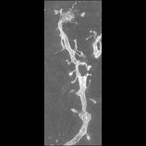  NCBI Organism:Mus musculus; Cell Types:CNS neuron (sensu Vertebrata) Cell Components:dendritic spine, dendrite;