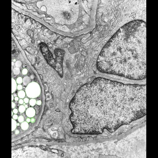  NCBI Organism:Macaca mulatta; Cell Types:kidney glomerular epithelial cell