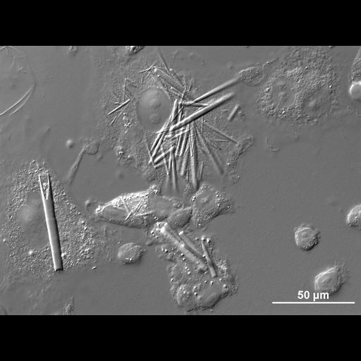  NCBI Organism:Cricetulus griseus; Cell Types:, ; Cell Components:crystalloid, , endoplasmic reticulum, inclusion body; Biological process:cytoplasm organization, endoplasmic reticulum organization;