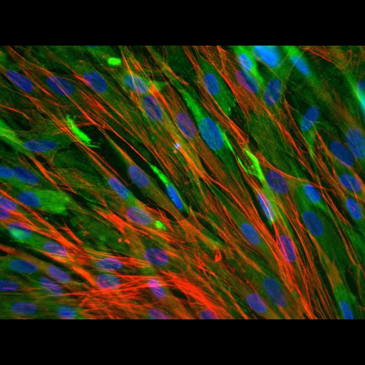  Cell Types:skeletal muscle cell Cell Components:cytoskeleton, nucleus;