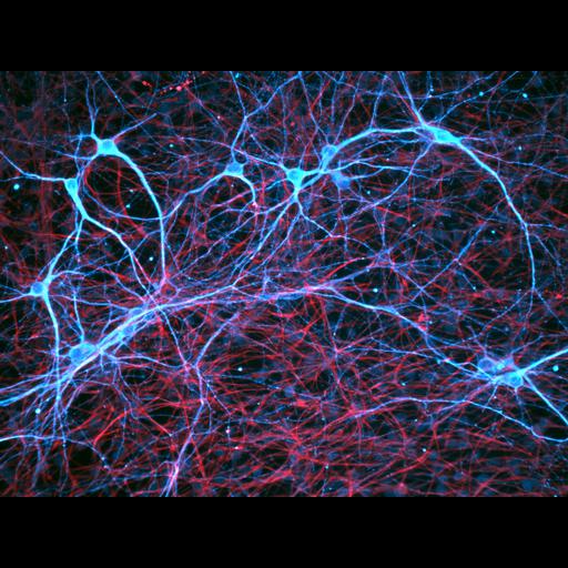  NCBI Organism:Rattus norvegicus; Cell Components:dendrite, cytoskeleton;