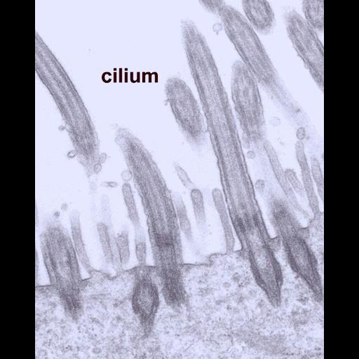  NCBI Organism:Mus musculus; Cell Components:cilium