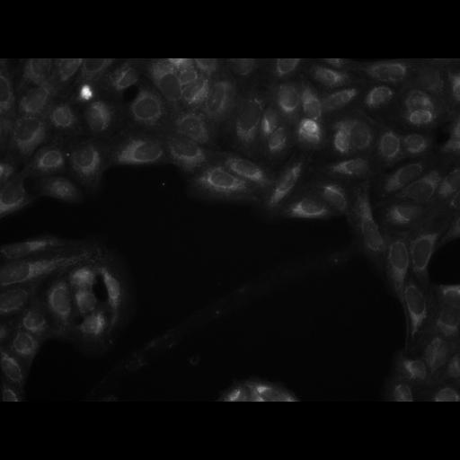  NCBI Organism:Homo sapiens, ; Cell Components:cell; Biological process:response to chemical stimulus;