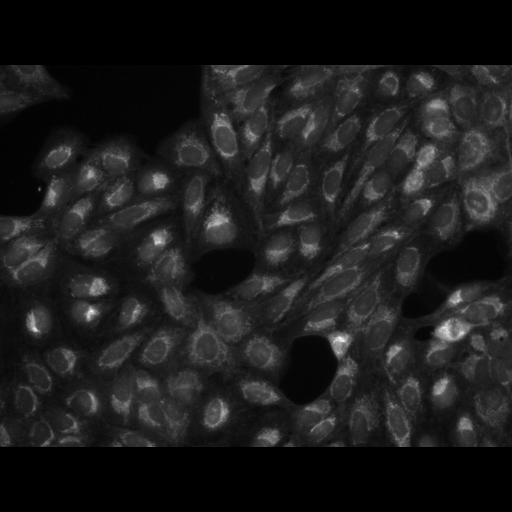  NCBI Organism:Homo sapiens, ; Cell Components:cell; Biological process:response to chemical stimulus;