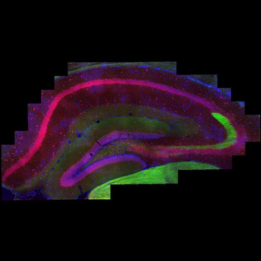  NCBI Organism:Mus musculus, , ; Cell Types:pyramidal cell, ; Cell Components:cell body, neuronal cell body membrane, nucleus; Biological process:hippocampus development, , , , , , , , , , , , ;