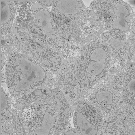  NCBI Organism:Chlamydia trachomatis, ; Cell Types:; Cell Components:; Biological process:;