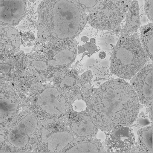  NCBI Organism:Chlamydia trachomatis, ; Cell Types:; Cell Components:; Biological process:;