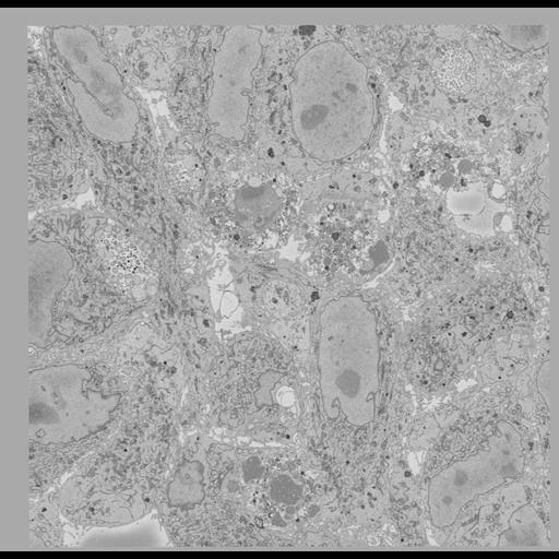  NCBI Organism:Chlamydia trachomatis, ; Cell Types:; Cell Components:; Biological process:;